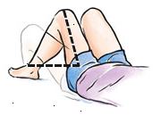 Το γόνατο στην προσβεβλημένη πλευρά θα πρέπει να αντιμετωπίσει κατ 'ευθείαν προς τα εμπρός ή να αποδειχθεί ένα κομμάτι. Μην περιστρέφετε το γόνατό σας προς τα μέσα. Το γόνατο στην προσβεβλημένη πλευρά θα πρέπει να αντιμετωπίσει κατ 'ευθείαν προς τα εμπρός ή να αποδειχθεί ένα κομμάτι. Μην περιστρέφετε το γόνατό σας προς τα μέσα.