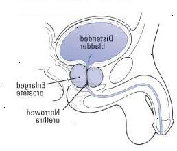 Προστάτης Προστάτης