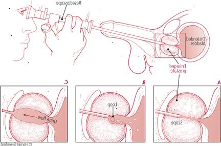 Προστάτης Προστάτης
