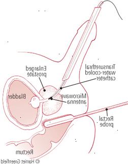 Προστάτης Προστάτης