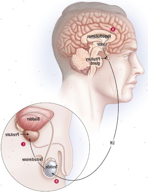 Πώς θεραπεία με αυξητική ορμόνη επηρεάζει τον καταρράκτη ανδρογόνων Πώς θεραπεία με αυξητική ορμόνη επηρεάζει τον καταρράκτη ανδρογόνων