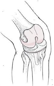 Νέα γόνατο βοηθά την καρδιά σας Νέα γόνατο βοηθά την καρδιά σας