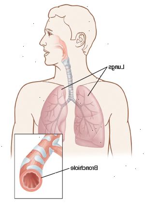 ΧΑΠ φωτοβολίδα