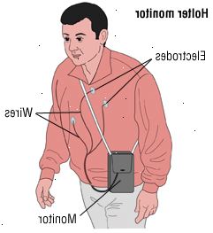 Η κολπική μαρμαρυγή 3 Η κολπική μαρμαρυγή 3