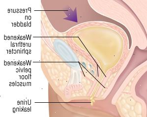 Κύστη Κύστη