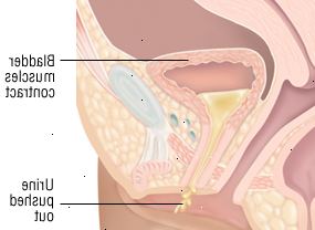 Κύστη Κύστη