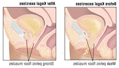 Κύστη Κύστη