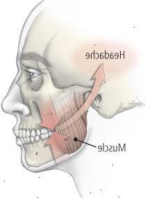 Αποφύγετε το άλεσμα Αποφύγετε το άλεσμα