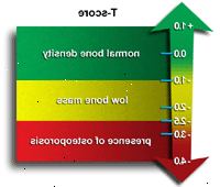 Εικονογράφηση του t-score και τι σημαίνει Εικονογράφηση του t-score και τι σημαίνει