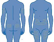 Οι θέσεις της ένεσης. Οι θέσεις της ένεσης.