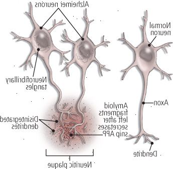 Πλακών και των αλλοιώσεων Πλακών και των αλλοιώσεων