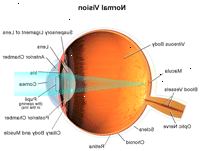 Απεικόνιση που καταδεικνύει φυσιολογική όραση Απεικόνιση που καταδεικνύει φυσιολογική όραση