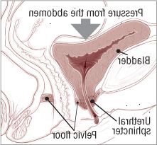 Ακράτεια από στρες