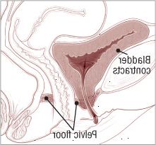Υπερδραστήριας ουροδόχου κύστης