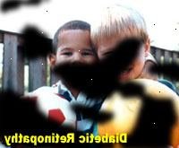 Φωτογραφία Προσομοίωση: διαβητική αμφιβληστροειδοπάθεια