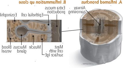 Φλεγμονή Φλεγμονή