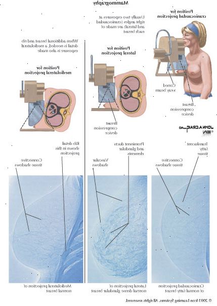 Κάντε κλικ για μεγέθυνση: τι συμβαίνει κατά τη διάρκεια μιας μαστογραφίας