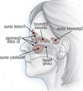 Ανατομία των παραρρινίων κόλπων