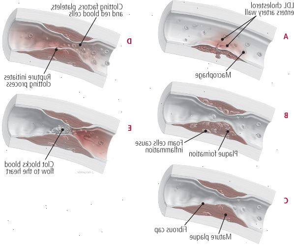 Μέσα στο τοίχωμα του αιμοφόρου αγγείου