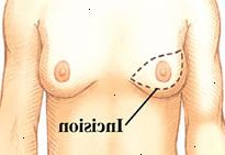 Στήθη Στήθη