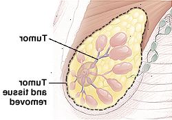 Αποκομμένη άποψη των μαστών Αποκομμένη άποψη των μαστών