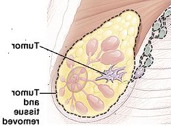 Αποκομμένη άποψη των μαστών Αποκομμένη άποψη των μαστών