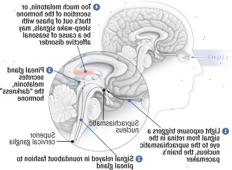 Εποχιακή συναισθηματική διαταραχή: εγκεφάλους που δεν προτιμούν τα σκοτεινά χρώματα Εποχιακή συναισθηματική διαταραχή: εγκεφάλους που δεν προτιμούν τα σκοτεινά χρώματα